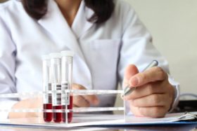 Притеснява ли ви анемия? Опитайте този народен лек с коприва и лимон 11 anemia 324 Copy